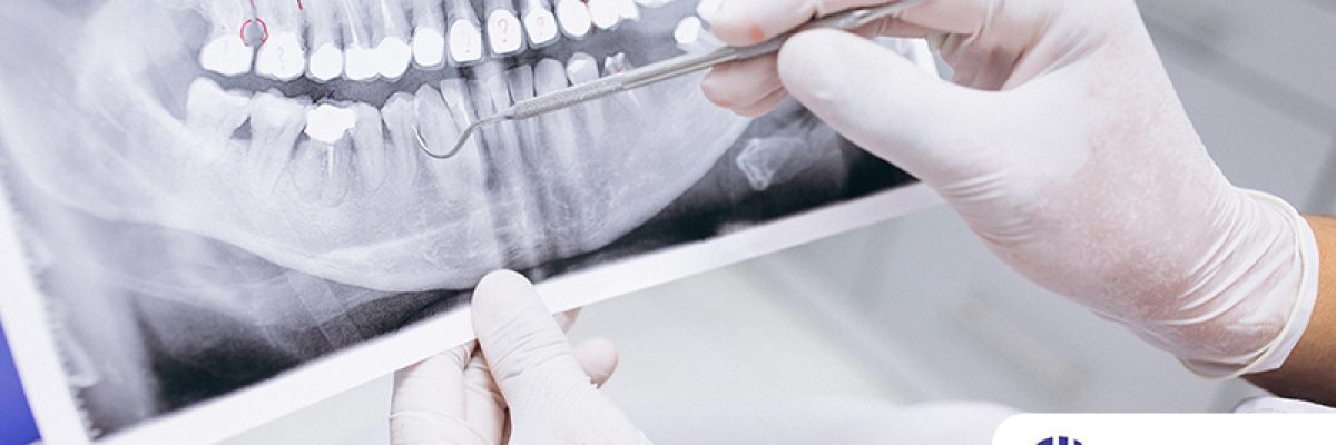 Quero Contratar Novos Dentistias Como Funcionam Os Contratos De Trabalho Para Dentistas Post Capital Assessoria Contabilidade Em Brasília - Contabilidade em Brasília